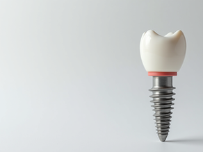 Understanding the Cost of Dental Implants in Ranchi: A Comprehensive Guide