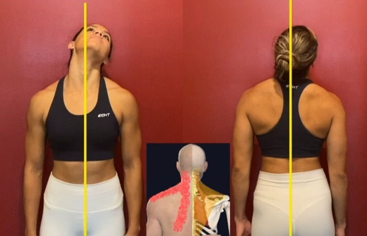 Biomechanical Neck Analysis_edited_edited