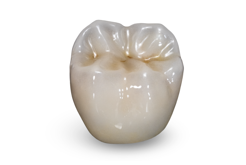 20210406_bruxzir-full-strength-19-posterior_008_SIG.png
