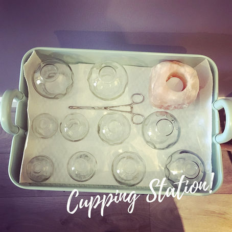 Everything You Need to Know about Cupping Therapy, Available Right Here in Kamloops