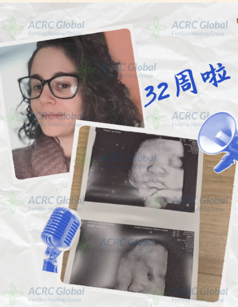 Surrogate H with ACRC surrogacy at 32 weeks ultrasound