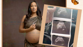 美国合法代孕案例,ACRC Surrogacy 代母 M 孕 37 周进入足月阶段,展示代孕妈妈孕期写真与超声波照片