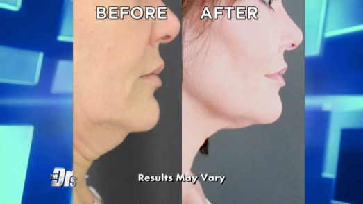 LV Laser Services