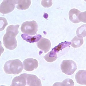 Plasmodium Falciparum
