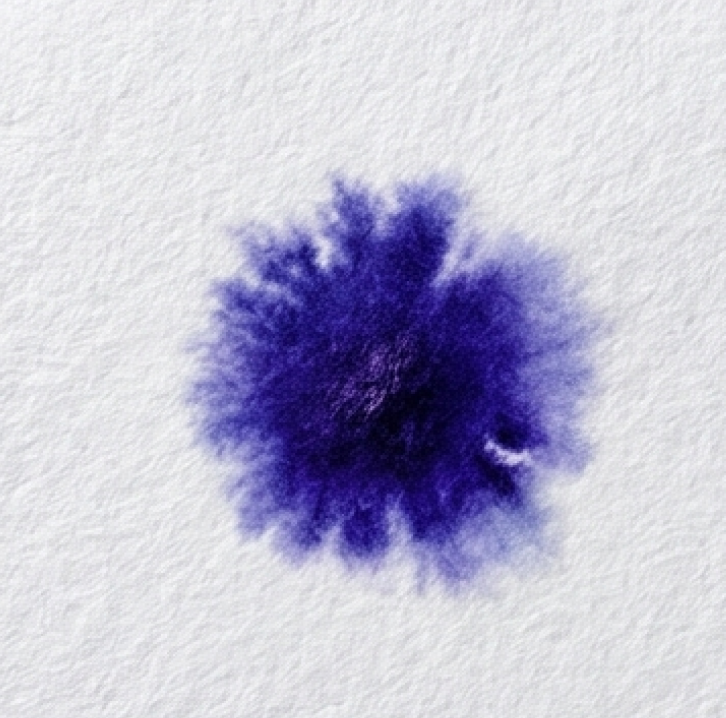 Is Candida albicans Oxidase Positive or Oxidase Negative? A Hidden Contradiction in the UK SMI That Every Microbiologist Should Know