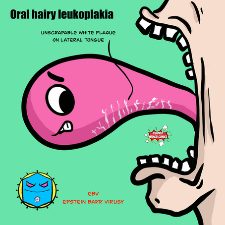 Hairy Leukoplakia