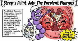 Streptococcal sore throat comic art
