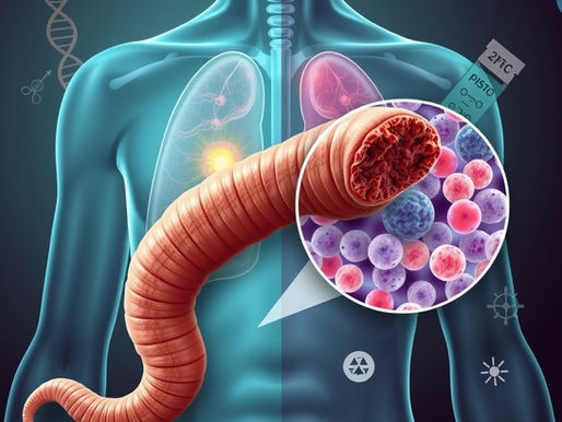 🧬A Tapeworm That Turned Malignant: Hymenolepis nana Mimicking Cancer in an HIV Patient