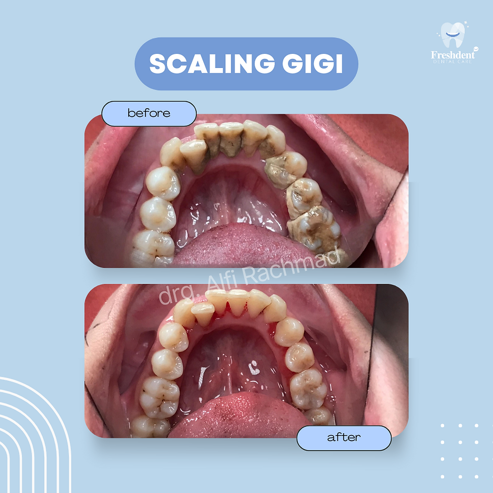 Konten Freshdent - 3 - 22