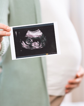 DraCybeleLascalaObstetricia