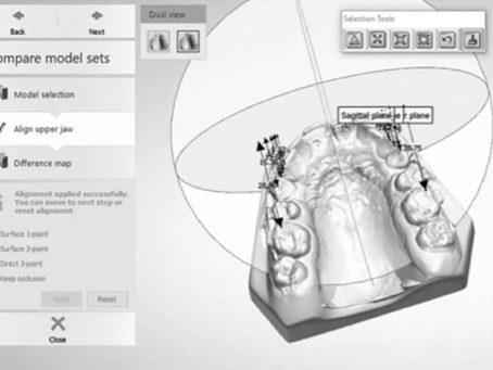 COMPARAÇÕES DE RETRAÇÕES DOS CANINOS