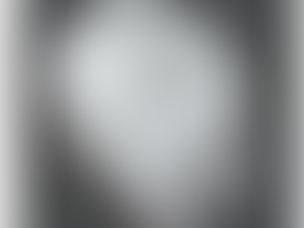 Comparação de seis diferentes contenções CAD/CAM versus contenção de Twistflex de aço inoxidável.