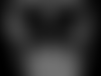 Tipos de assimetrias mandibulares e diferenças nas compensações dentarias de pacientes classe III.