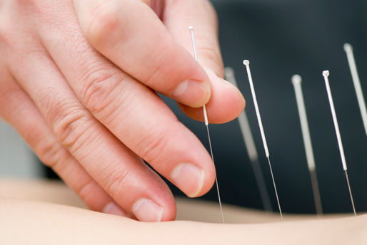 Finding Relief for Surrey TMJ: Why Surrey Acupuncture is the Key to Your Recovery