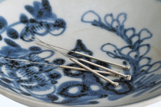 Migraine Treatment in Surrey : A Different Approach with Acupuncture