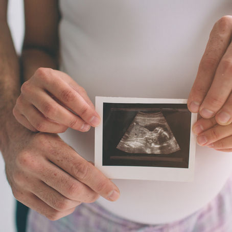 Ultrasound image of baby