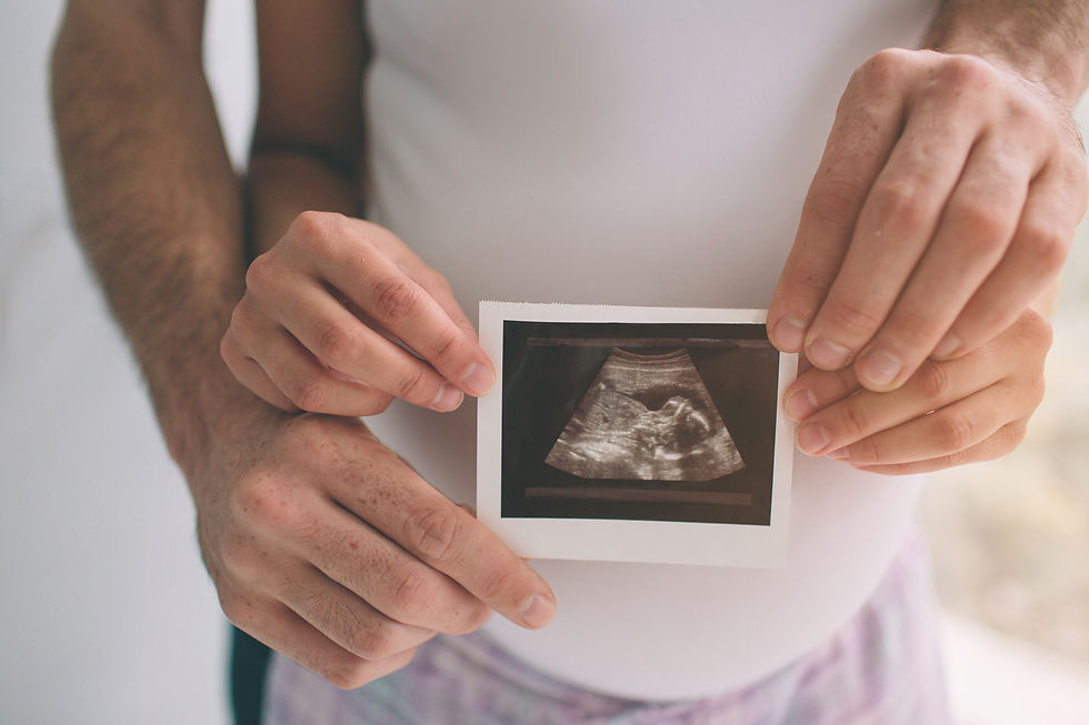 Ultrasound image of baby