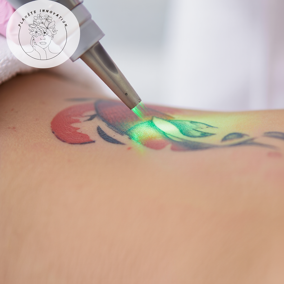 Processus Laser Détaillé: Action du laser sur les pigments d'encre du tatouage