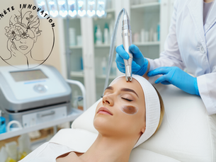 Traitement Laser Taches: Séance de traitement laser pour élimination des taches de vieillesse