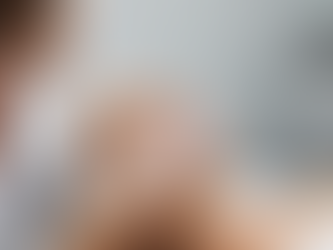 Traitement radiofréquence visage: Séance de radiofréquence pour le rajeunissement du visage