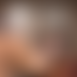 BECAUSE OF YOUR FAITH YOU WILL BE HEALED
MATTHEW 9:29 CEV