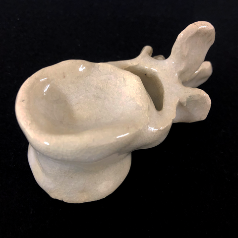Fractured Ceramic Vertabrae