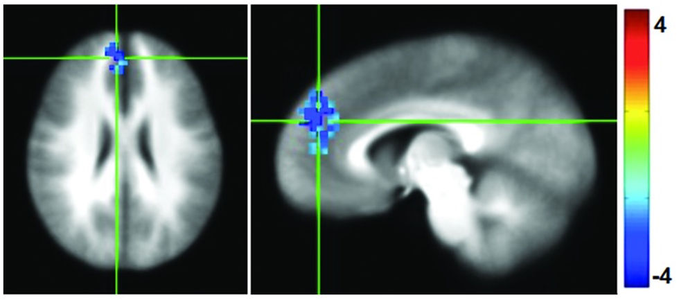 以上几个图是数据分析的结果。看不懂?没关系,研究人员基于这些严谨的数据得出的结论,我们肯定更能看得懂。