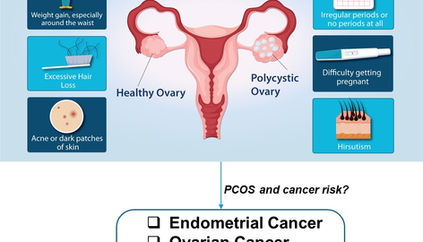 Understanding PCOS and Its Link to Cancer: What Every Woman Should Know
