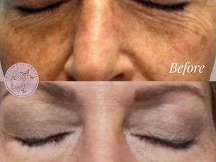 How to Treat Sun-Damaged Skin: Medical Solutions That Actually Work