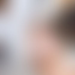 Feel Confident at the Table: Non-Surgical Facial Treatments That Boost Your Glow