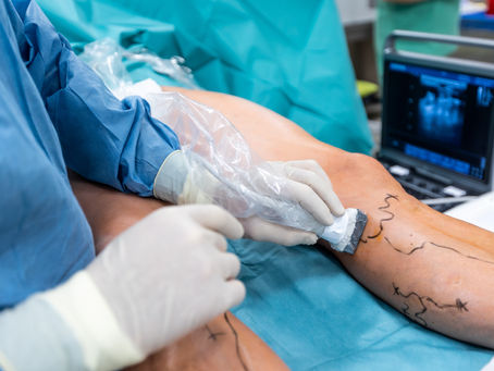 Vascular Surgery Fellowship