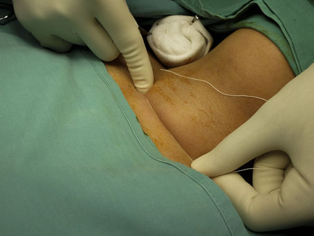 Endocrine Surgery Fellowship