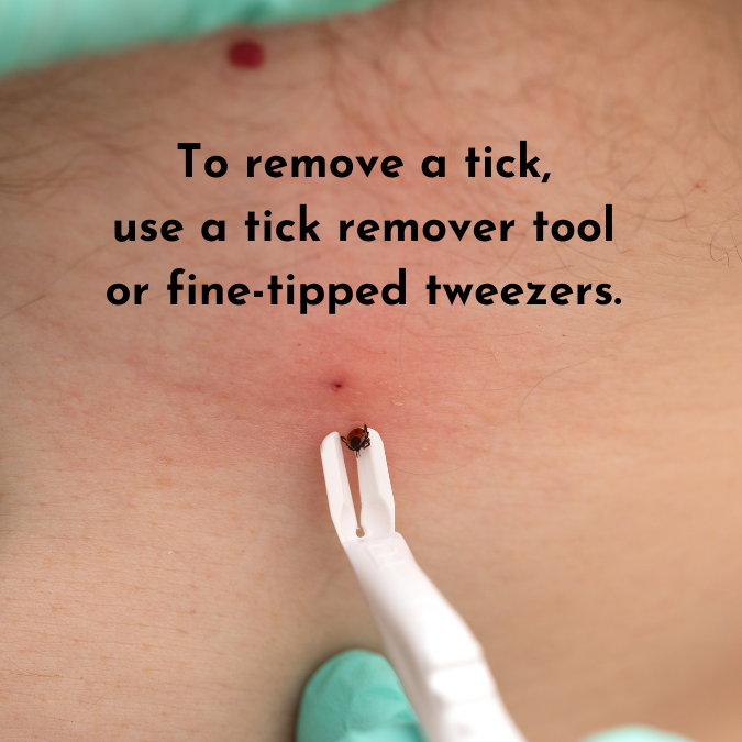 How to remove a tick with a tick removal tool