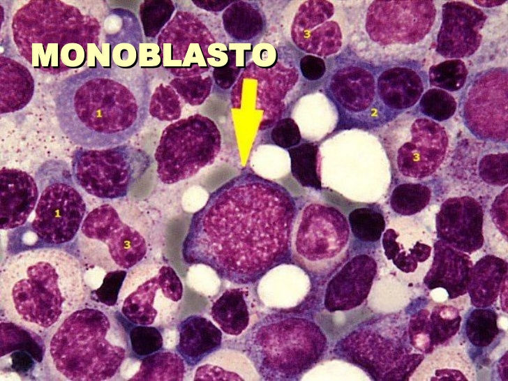 32) Monoblasto