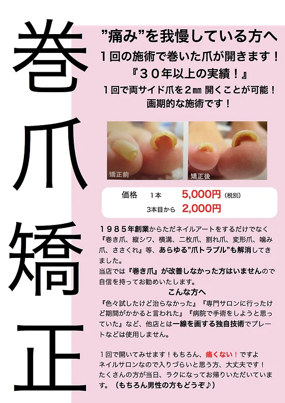 巻爪改善メニュー ネイルサロン マリアール 日本 巻爪改善メニュー ネイルサロン マリアール 日本