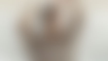 LOGINA SALAH PROVES THAT ‘VITILIGO IS JUST A COLOR’