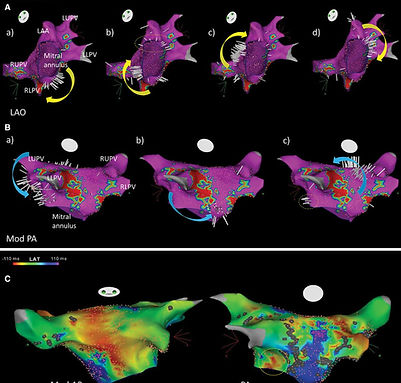 ripple mapping.jpeg