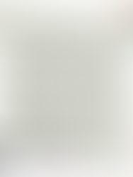 舒緩慢性頭痛的方式