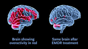 Frequencies of Yah & Attitude: A look at EMDR Therapy