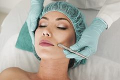 Gloved hands dermaplaning a woman's cheek with a small blade