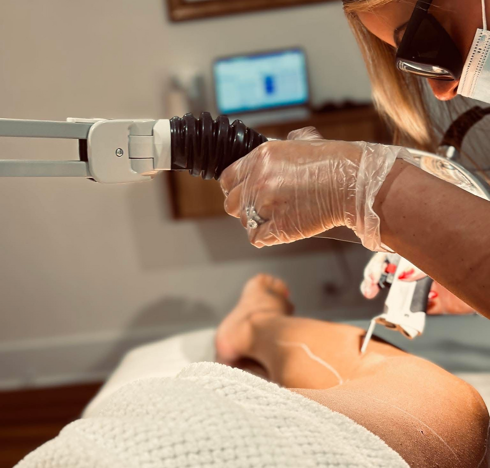 The Cynosure Elite iQ handpiece passing over a client's leg during a laser hair removal session
