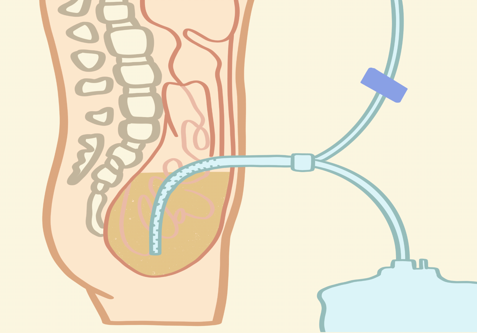 Infographic 3.GIF