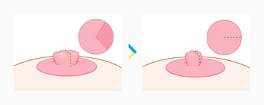 nipple-04-02.gif