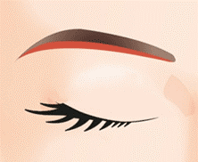 eyelid-06-08.gif
