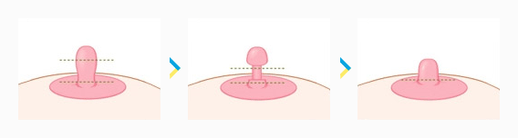 nipple-04-03.gif