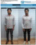 Posture Correction in Toronto