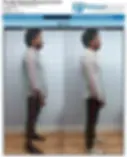 Posture Correction In Toronto