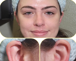 Lobe Piercing By Elle At Fine Ink Kissimmee