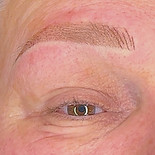 resultaat van een combibrow