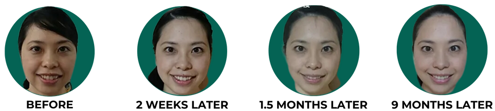 Face Yoga results